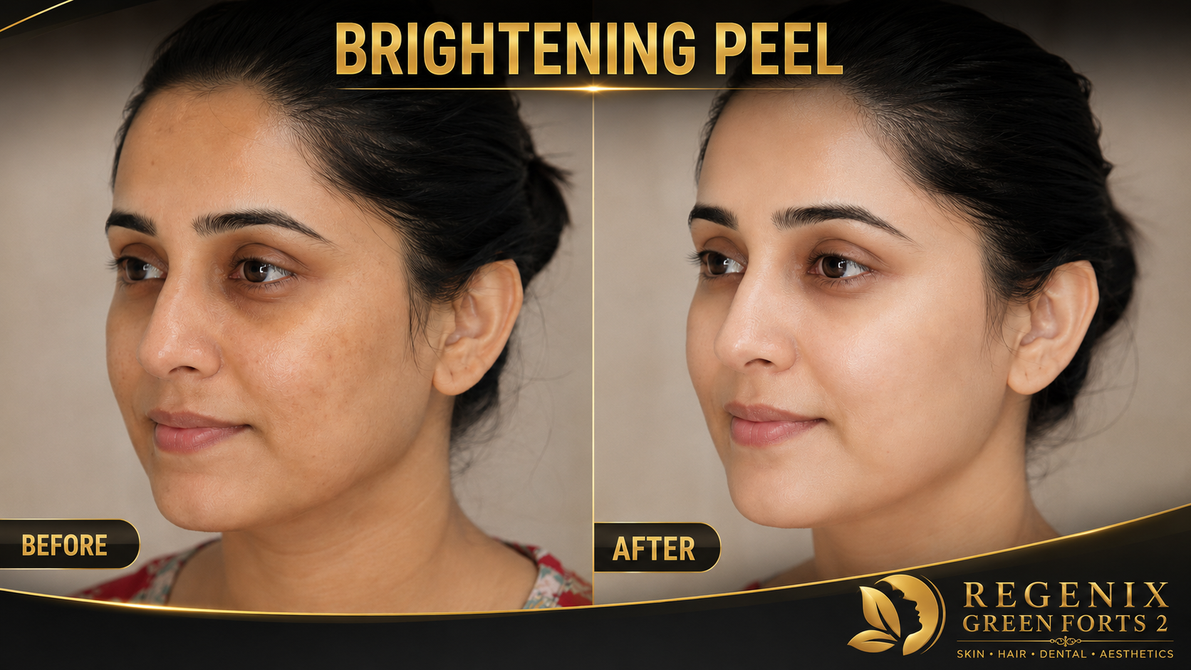Pigmentation Care